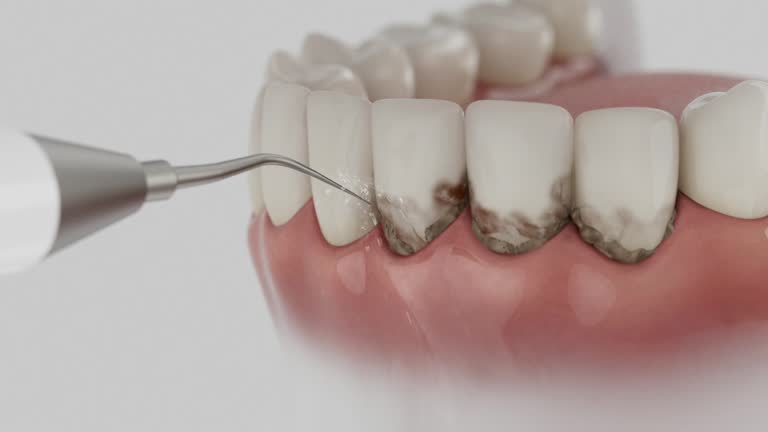 Reliable Tooth Extraction contractor in Knox County County, TN by Dentist Open Now